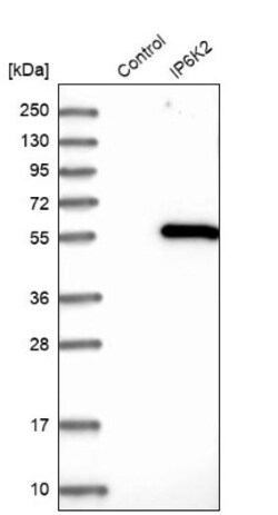 IHPK2 Antibody, Novus Biologicals 0.1mL; Unlabeled:Antibodies, Polyclonal